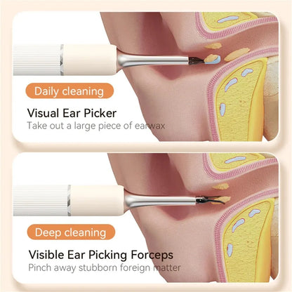 Camera Len Visual Ear Cleaner